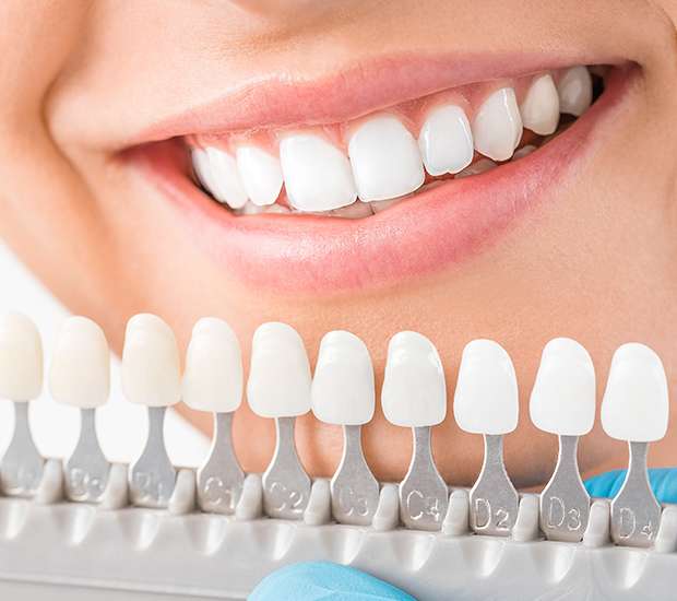 6 Cosmetic Dentistry Solutions That Transform Everyday Smiles