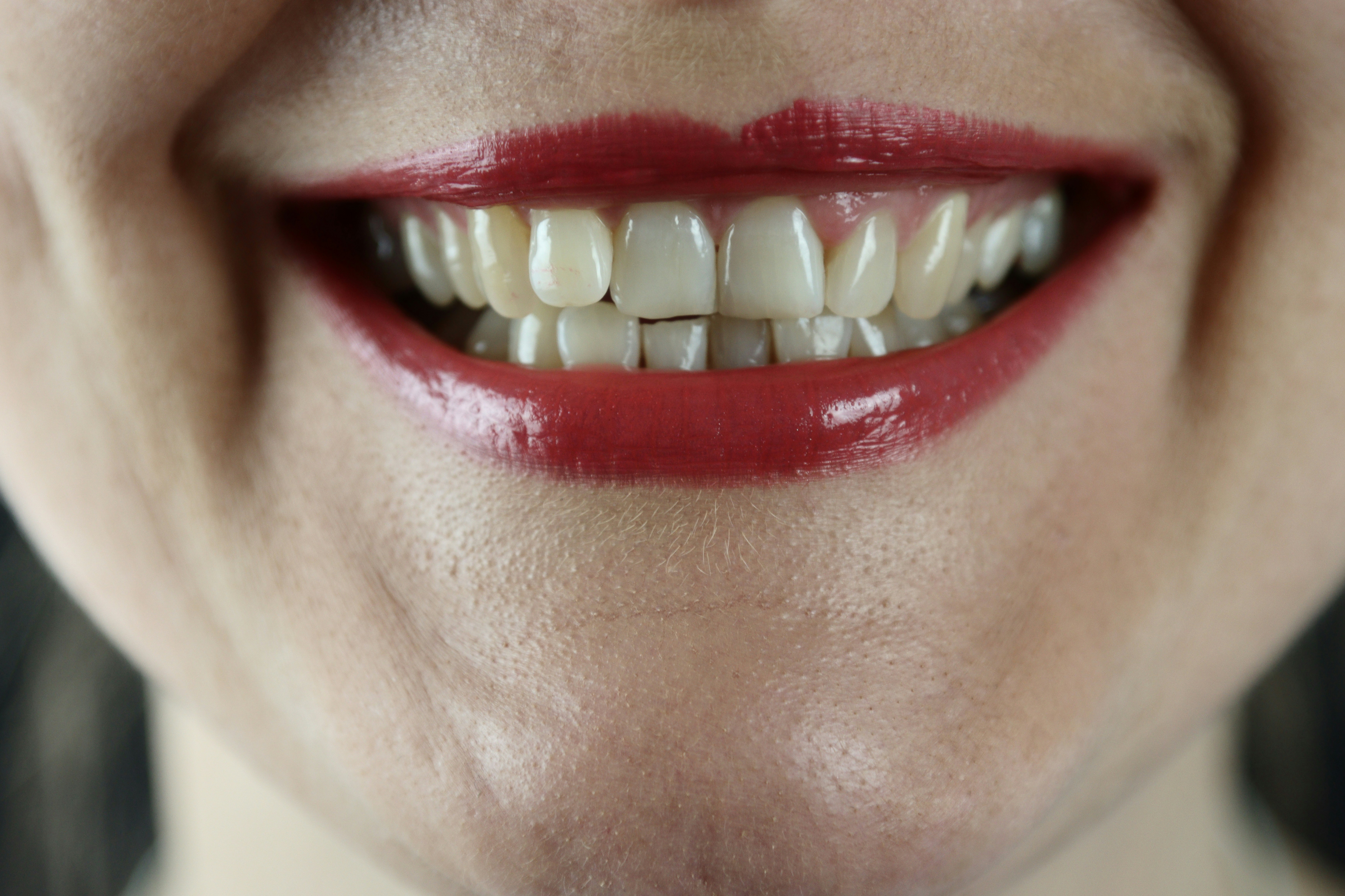 Why Cosmetic Dentistry Enhances More Than Just Smiles