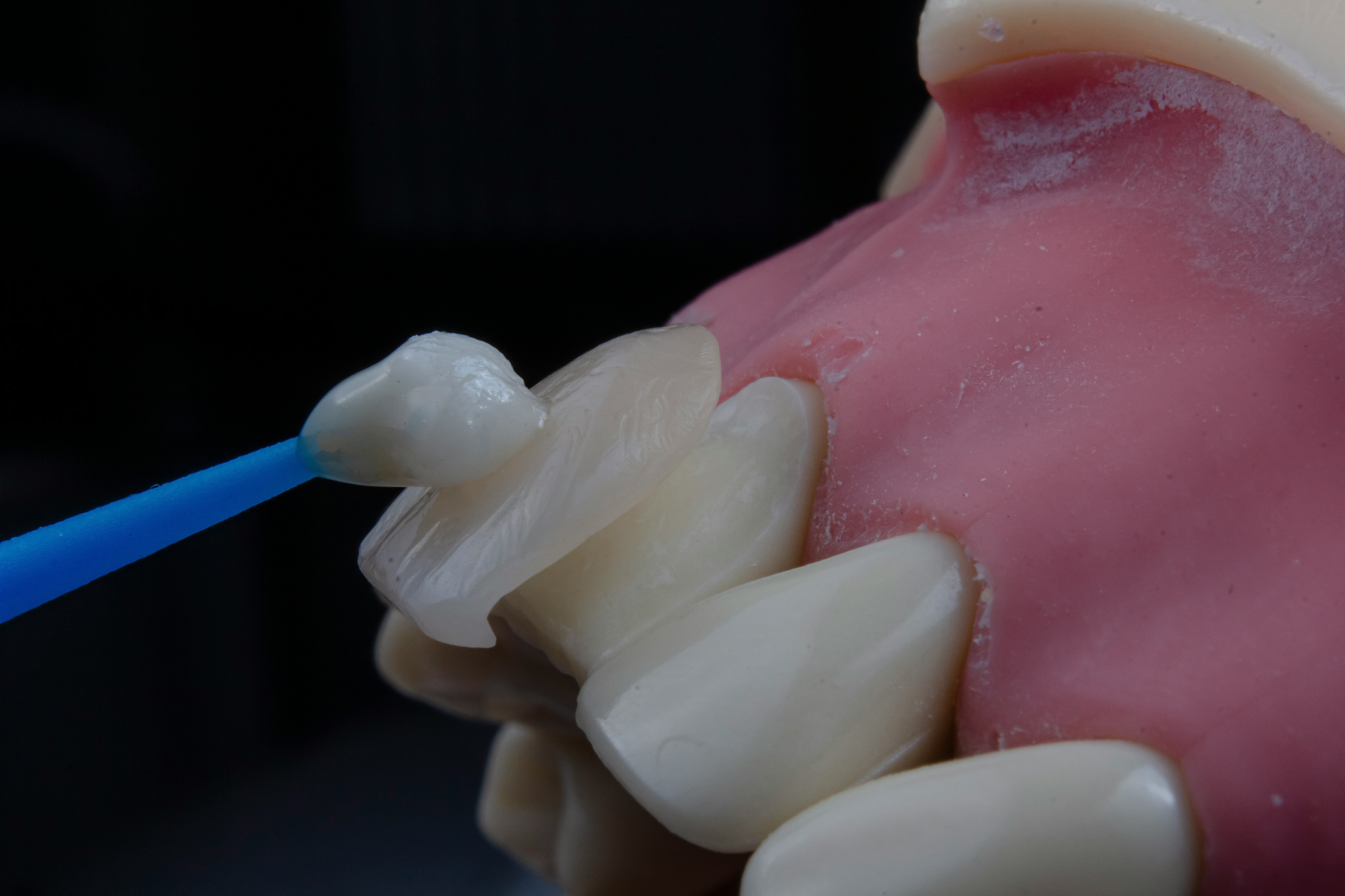 3 Cosmetic Dentistry Enhancements That Can Be Completed Quickly